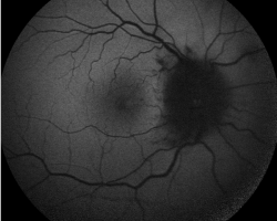 Auto fluorescence OD