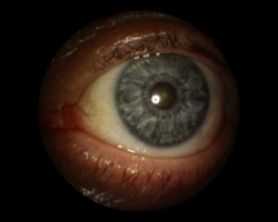 Oeil gauche