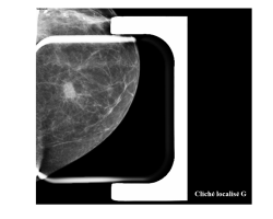 K sein mammo loc.png